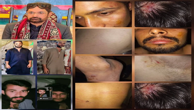 ڪوٽڙي ۾ قانون جي بالادستي ختم؟ بااثر ايم پي اي ڊاڪٽر سڪندر شورو جي سڳي ڀاڻيجَي طرفان نوجوان اغوا ۽ وحشي تشدد جو الزام